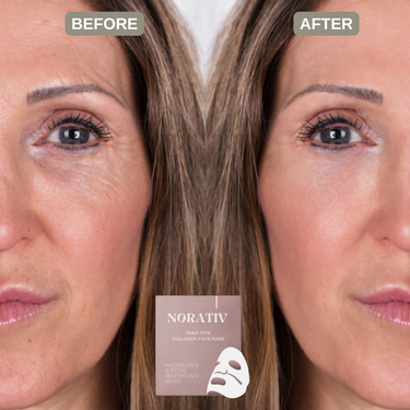 Firms, Lifts & Smooths — 75% Less Wrinkles